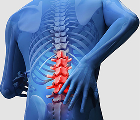 Lumbar Pain